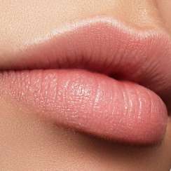 Beautiful Lips Filler