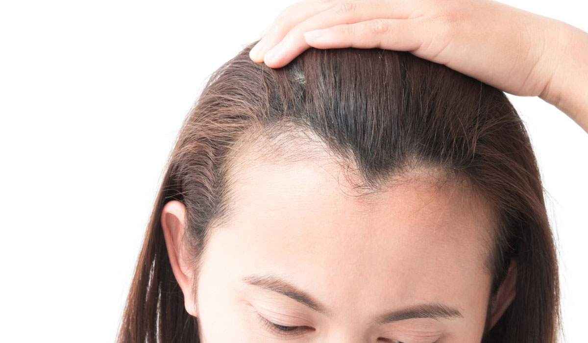 Hair Loss Treatment